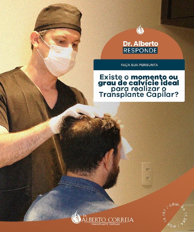 Implante de cabelo masculino valor