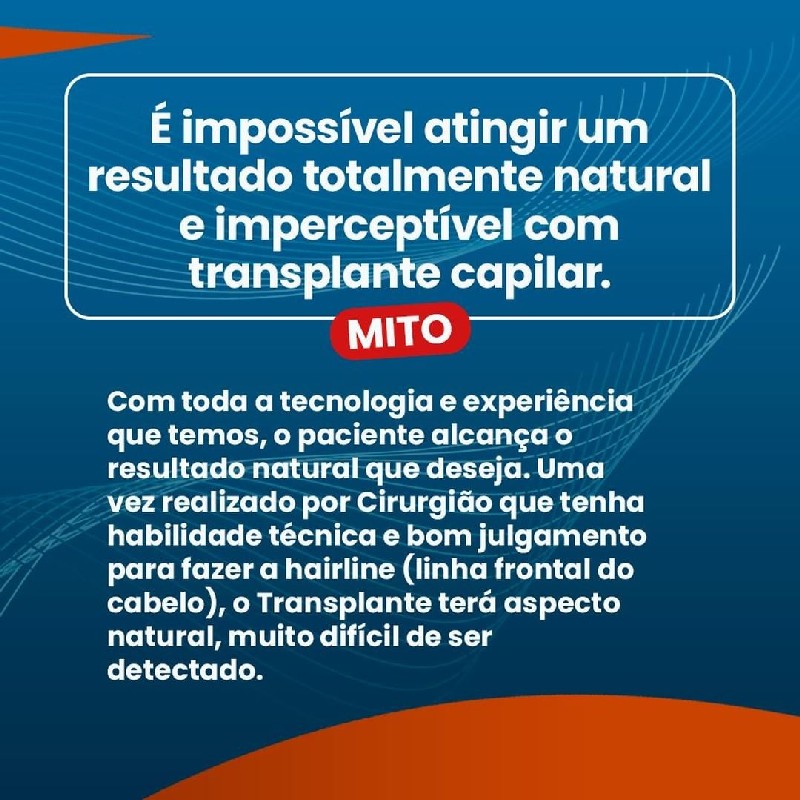 Implante capilar masculino preço