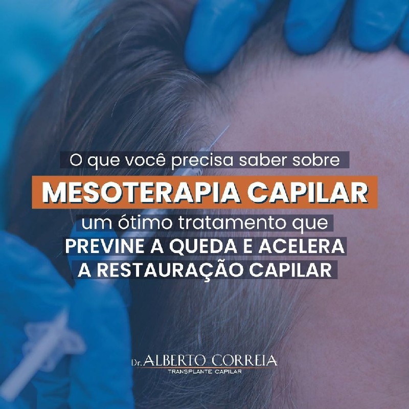 Intradermoterapia capilar calvície