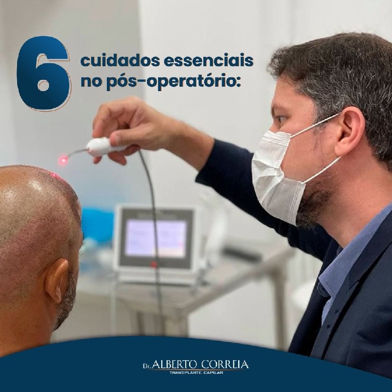 Transplante capilar bahia
