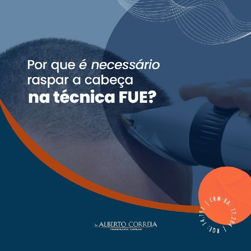 Transplante capilar calvície preço