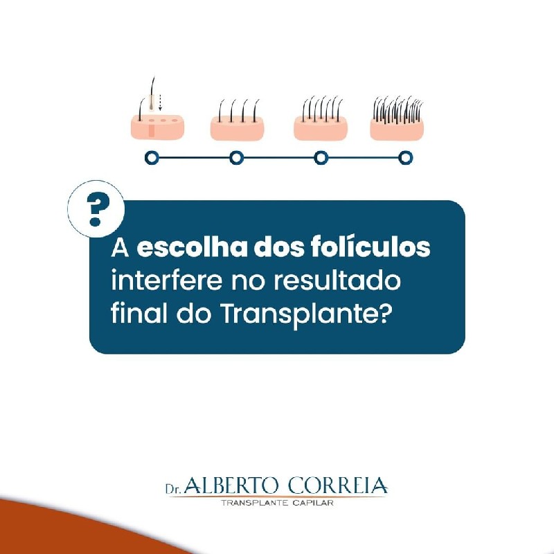Transplante capilar masculino preço